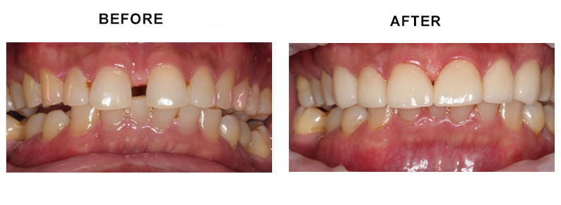 BEFORE AFTER PHOTO