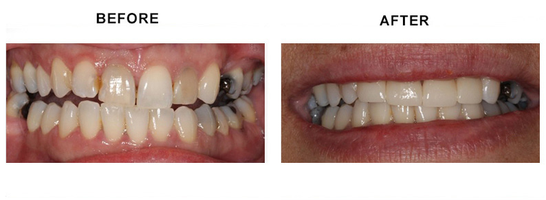 BEFORE AFTER PHOTO
