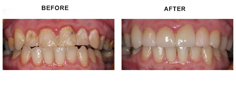 BEFORE AFTER PHOTO